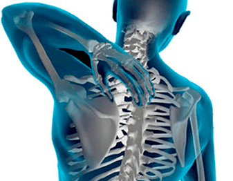 prejavy osteochondrózy hrudnej chrbtice